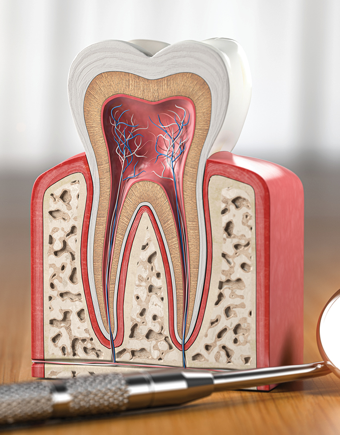 Services Root Canal 1