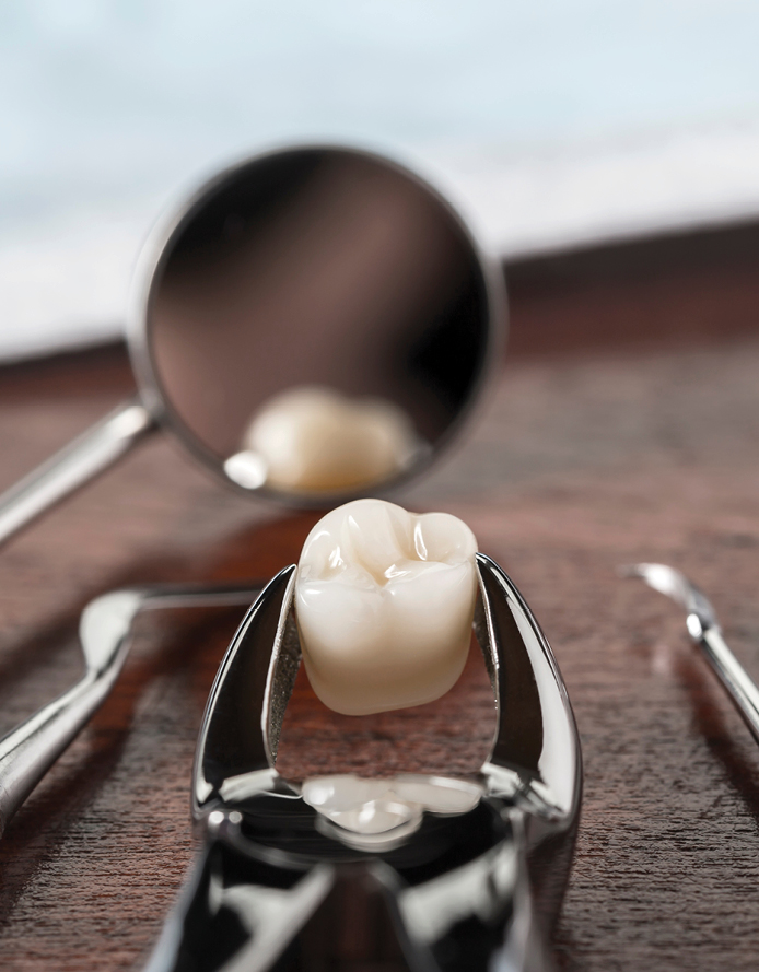Services Wisdom Teeth 1