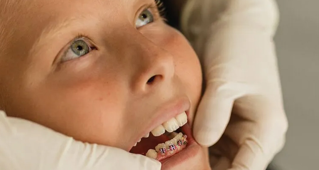 Child smiling during a check-up with our kids dentist Ormeau team