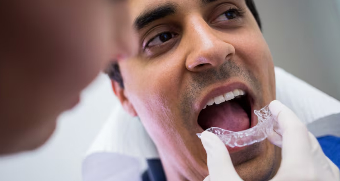 Dentist fitting a clear custom night guard Ormeau patient